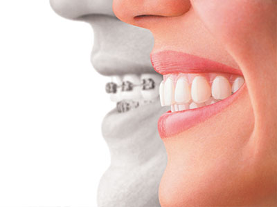 Scott E. Learn, DMD | Teeth Whitening, Oral Exams and Implant Dentistry