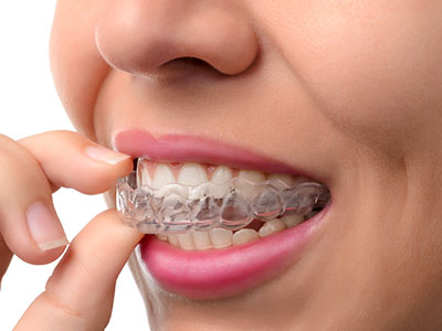 Scott E. Learn, DMD | Dental Cleanings, Snoring Appliances and Fluoride Treatment
