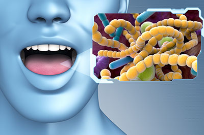 Scott E. Learn, DMD | All-on-4 reg , Dentures and Night Guards