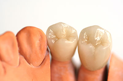 Scott E. Learn, DMD | Emergency Treatment, E4D and Oral Cancer Screening