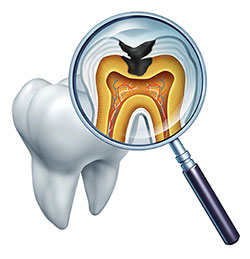 Scott E. Learn, DMD | Intraoral Camera, Full Mouth Reconstruction and Implant Dentistry