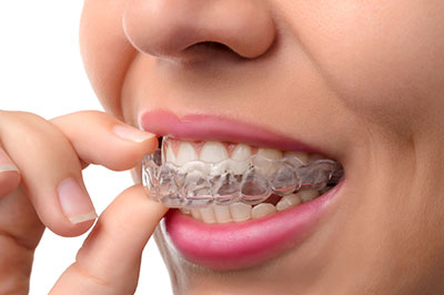 Scott E. Learn, DMD | Inlays  amp  Onlays, All-on-6 reg  and Emergency Treatment