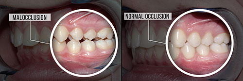 Scott E. Learn, DMD | Cosmetic Dentistry, Full Mouth Reconstruction and Dental Sealants