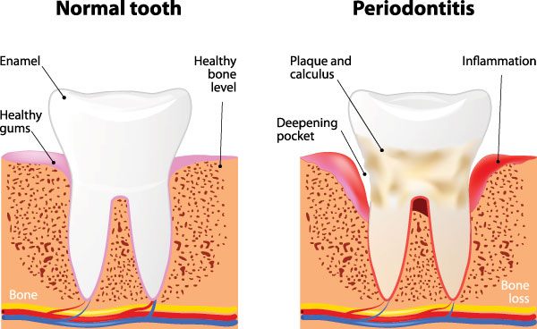 Scott E. Learn, DMD | Dermal Fillers, Night Guards and Ceramic Crowns