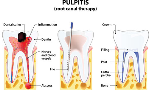 Scott E. Learn, DMD | Oral Exams, Dental Cleanings and Extractions