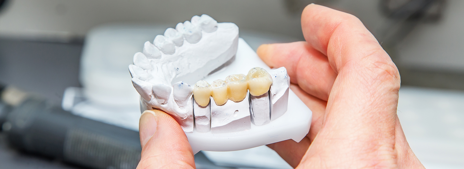 Scott E. Learn, DMD | Extractions, TMJ Disorders and Fluoride Treatment