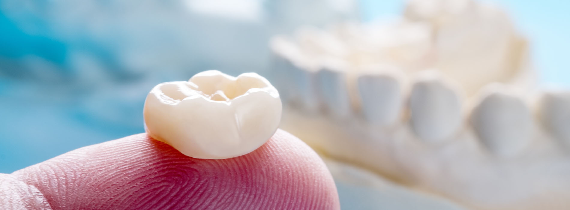 Scott E. Learn, DMD | Extractions, Teeth Whitening and Digital Impressions