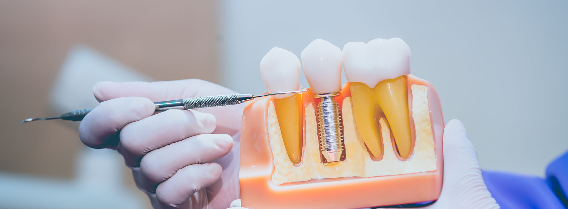 Scott E. Learn, DMD | Pediatric Dentistry, Periodontal Treatment and Implant Dentistry