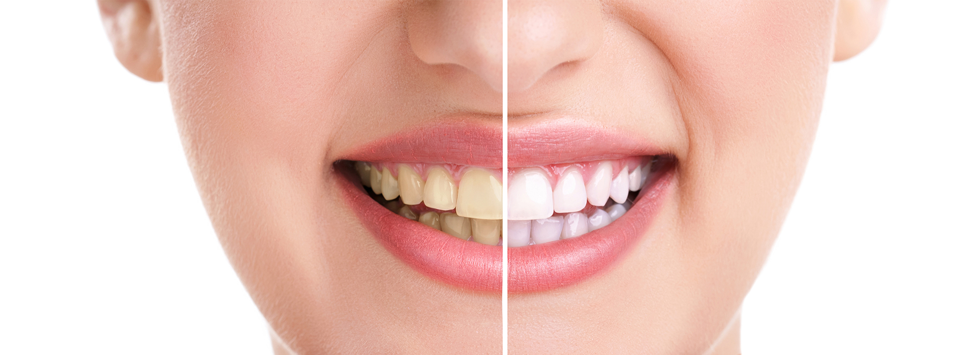 Scott E. Learn, DMD | CEREC, E4D and Extractions