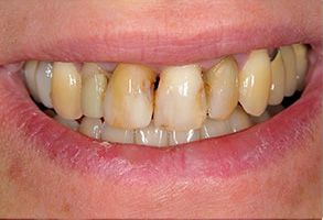 Scott E. Learn, DMD | CEREC, Dental Fillings and Emergency Treatment